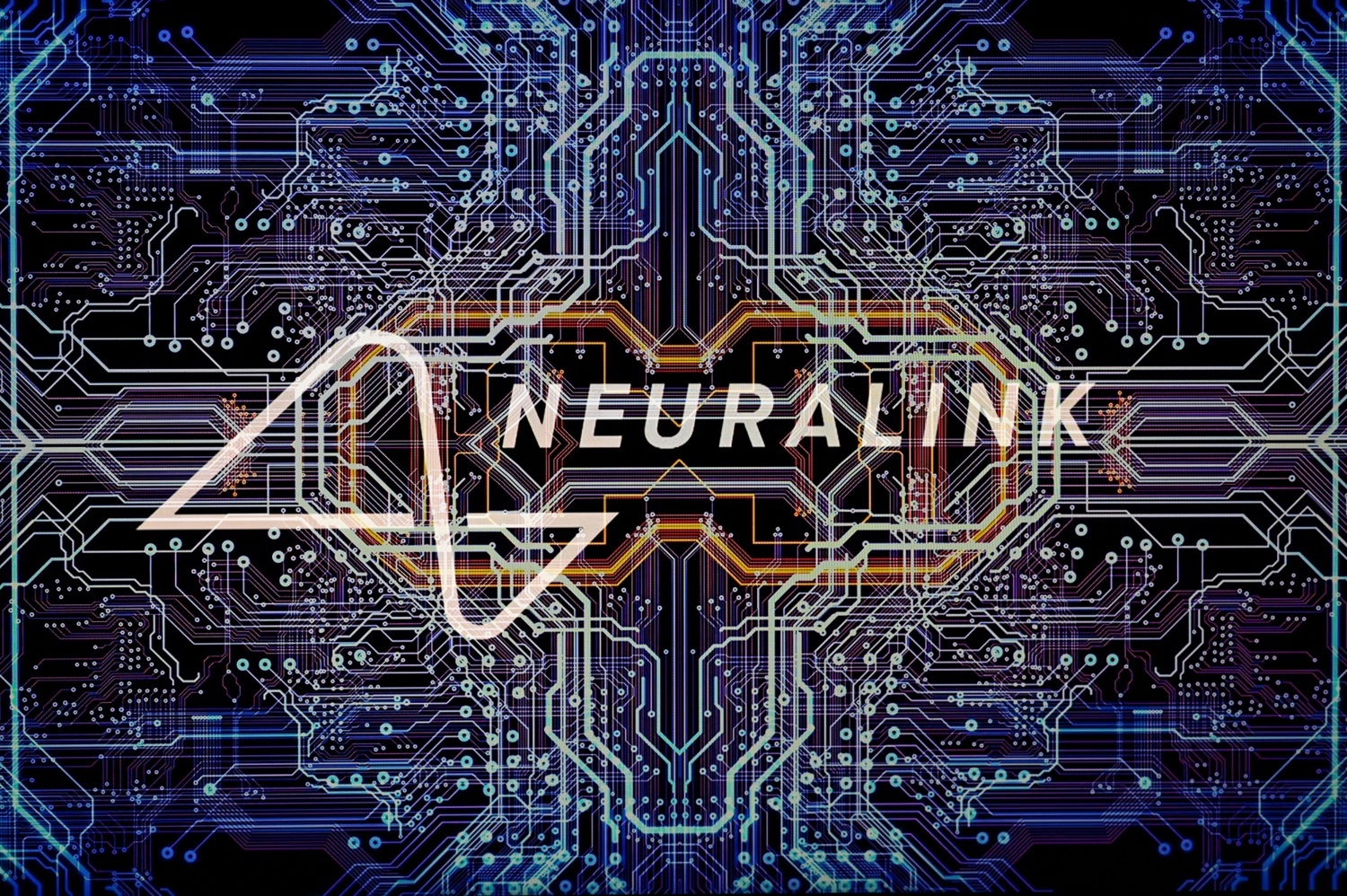 neuralink-in-beyin-implantini-elde-etmis-ikinci-pasient-fikir-gucu-vasitesile-counter-strike-oynamagi-oyrenib-video